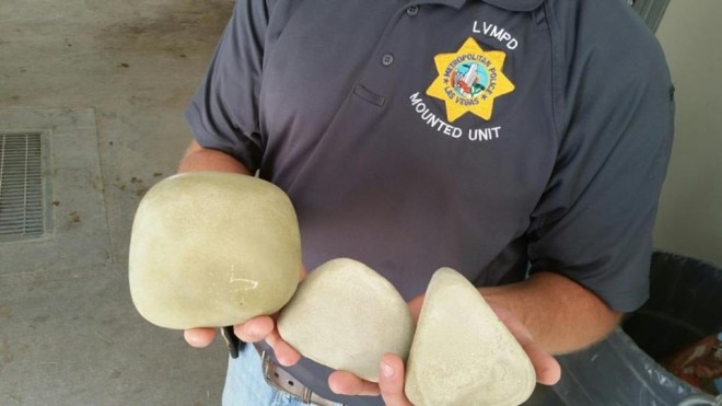 Vegas cop had these stones removed from his guts but is coming back at work
